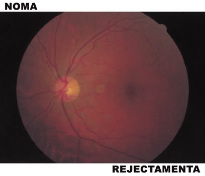 NOMA / REJECTAMENTA - SPLIT CD - Click Image to Close