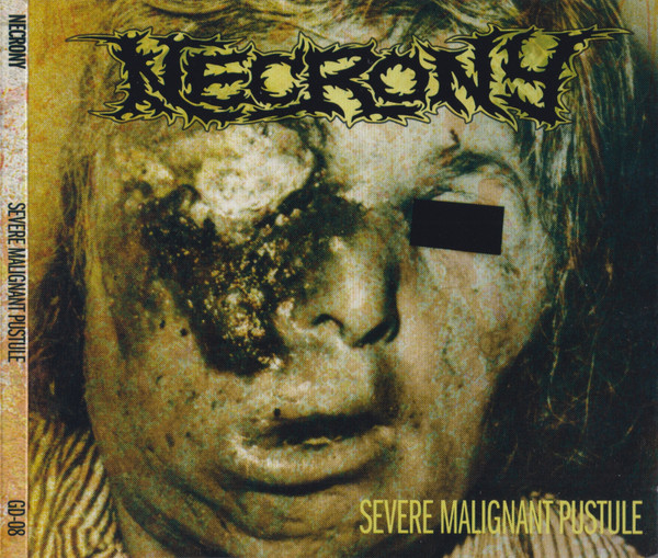 NECRONY - "SEVERE MALIGNANT PUSTULE" CD WITH SLIPCASE