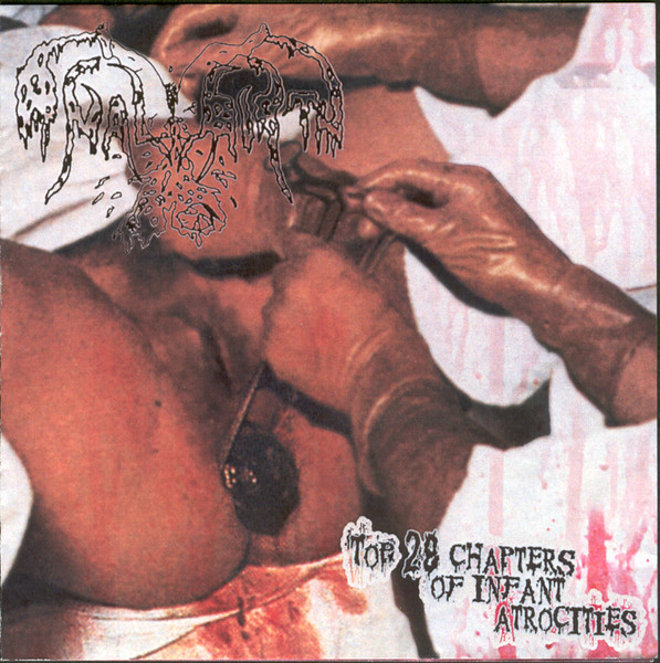 ANAL BIRTH - "TOP 28 CHAPTERS OF INFANT ATROCITIES"