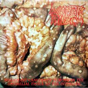 LYMPHATIC PHLEGM - "MALIGNANT CANCEROUS TUMOUR IN THE..." LP