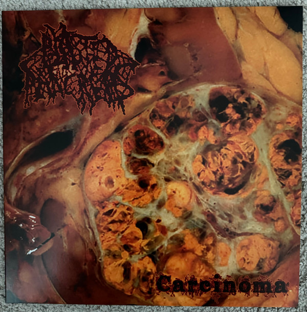 BLASTED PANCREAS - "CARCINOMA" LP (Red Vinyl)