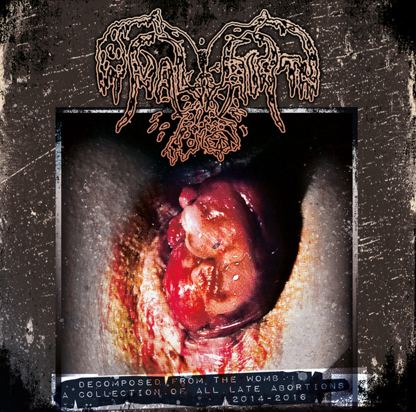 ANAL BIRTH - "DECOMPOSED FROM THE WOMB : A COLLECTION OF ALL..."