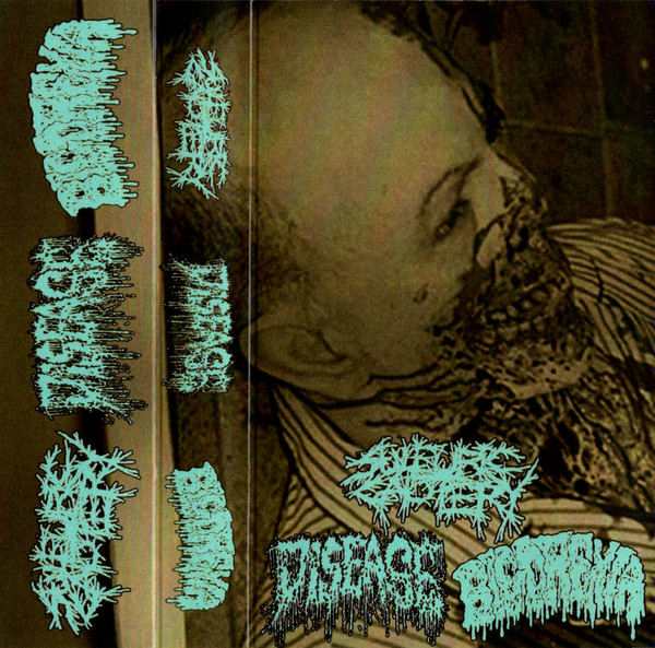 SULFURIC CAUTERY / DISEASE . BIGOREXIA - 3 WAY SPLIT TAPE